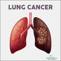 Lung Cancer Big 898