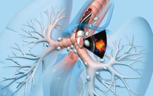 Ungthukhiquan1 16402298203351025431023